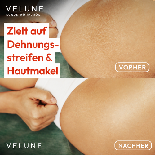 Velune Straffendes Körperöl